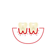 Manje od 3 puta nedeljno